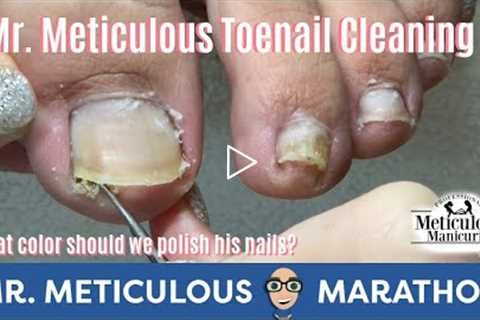 👣Satisfying Impacted Toenail Cleaning👣 #MrMeticulousMarathon