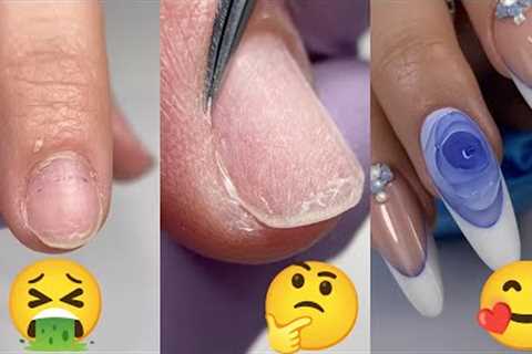 ✨273✨ 10+ Beautiful Nail Transformation Acrylic Nail Art Designs Tutorial Ideas