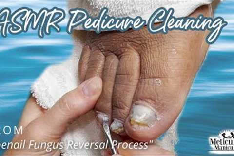 👣ASMR Pedicure Cleaning💆‍♀️Toenail Fungus Reversal Process👣