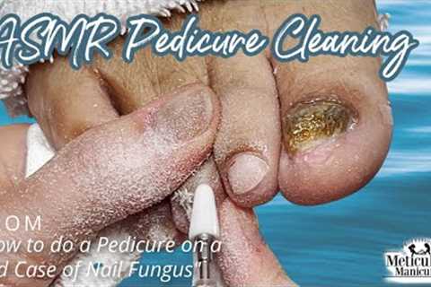 👣ASMR Pedicure Cleaning💆‍♀️How to do a Pedicure on a Bad Case of Nail Fungus👣