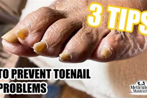 👣3 Pedicure Tips to Restore, Preserve, and Prevent Toenail Problems👣