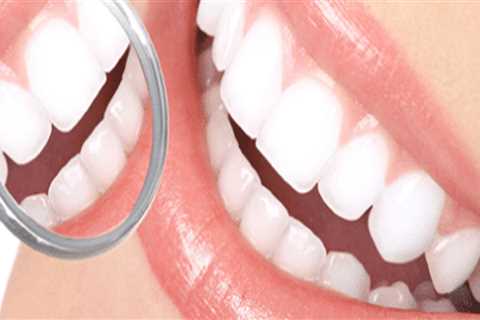 Is Cosmetic Dentistry Permanent