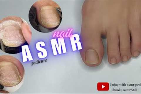 asmr nail | asmr pedicure cleaning