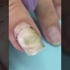 What Happened 🤢After Using Nail Glue