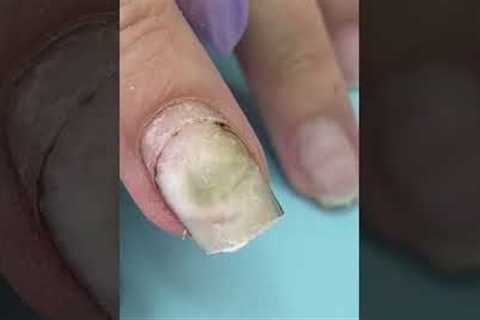 What Happened 🤢After Using Nail Glue