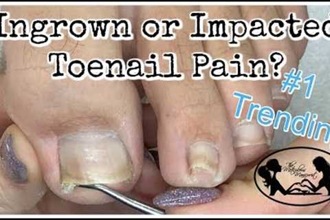 Impacted or Ingrown Toenail Pedicure Tutorial