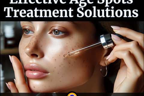 Effective Age Spots Treatment Solutions